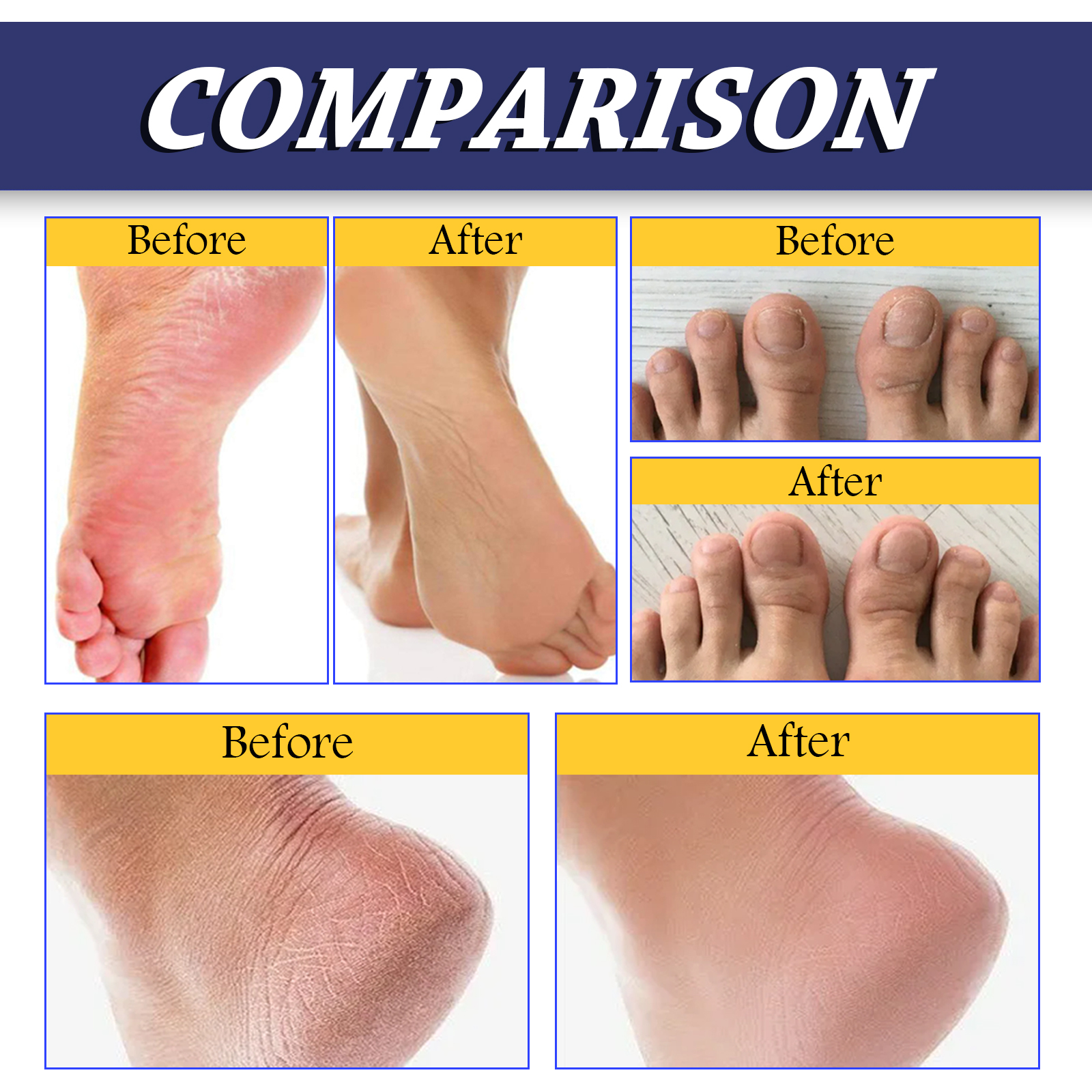 South Moon Urea Hand And Foot Cream, Anti-Crack Peeling Repair Skin Crack Dry Moisturizing Skin Soothes Skin - Image 4
