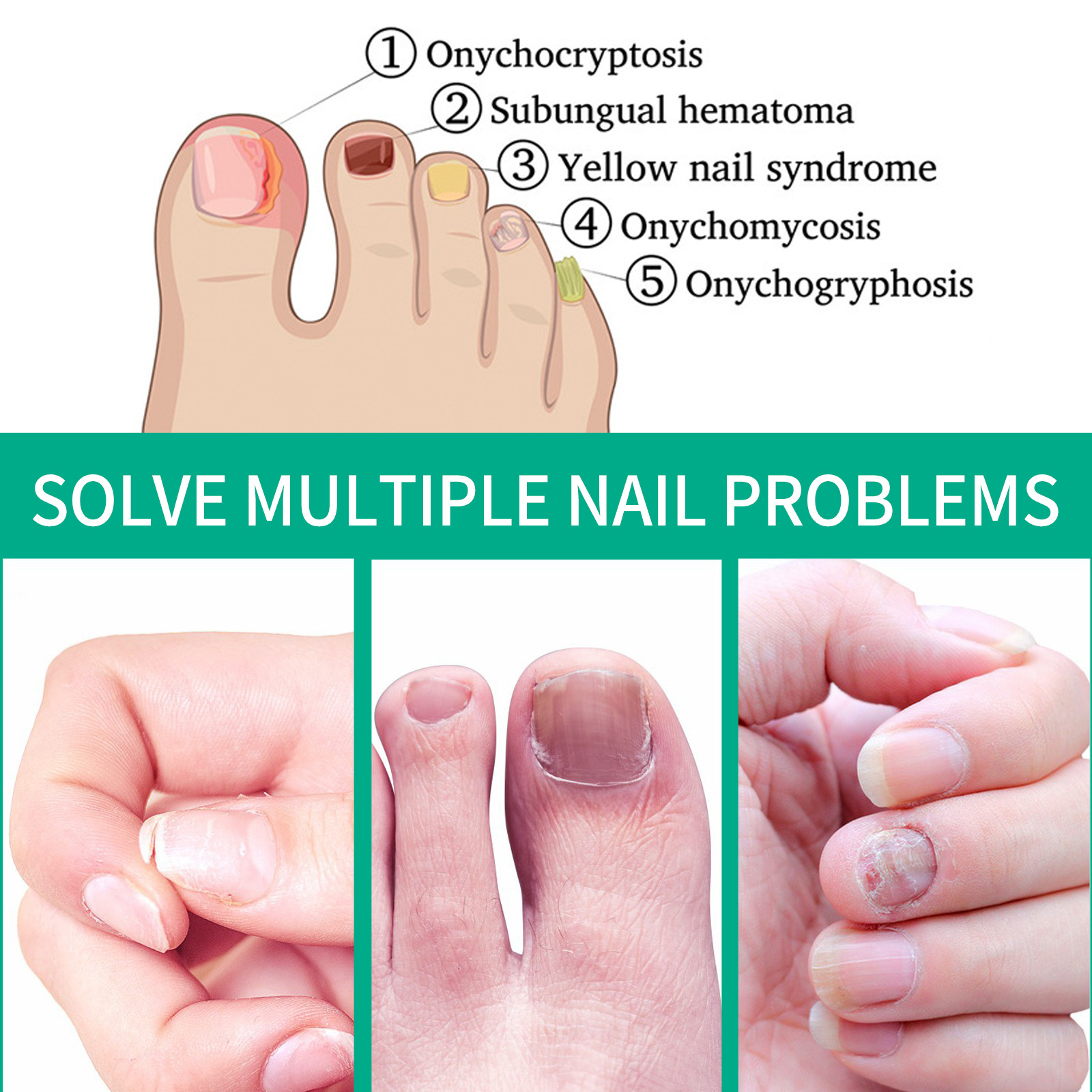 South Moon Nail Care Essence Moisturizes And Cleanses Hands, Feet And Nails And Brightening Nails Daily Care Essence - Image 3
