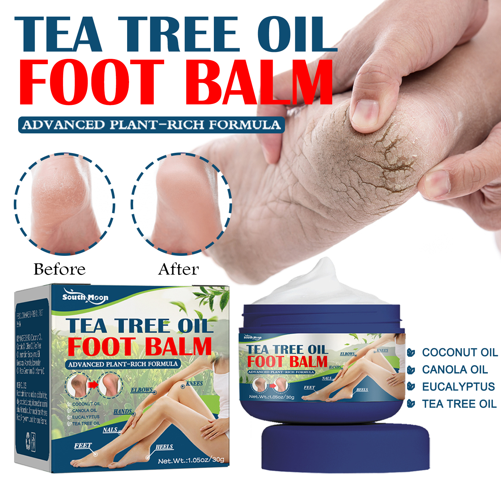 South Moon Urea Hand And Foot Cream, Anti-Crack Peeling Repair Skin Crack Dry Moisturizing Skin Soothes Skin - Image 2