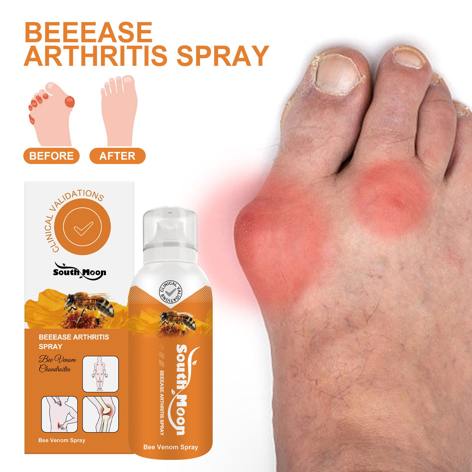 South Moon Beease Arthritis Spray, Relieve Joint Pain Shoulder Cervical Vertebra Lumbar Body Care Spray